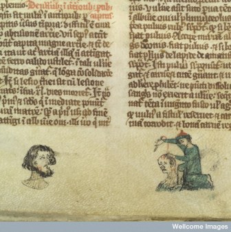 L0037333 Man with cheek wound; surgeon sews head wound, 14th C